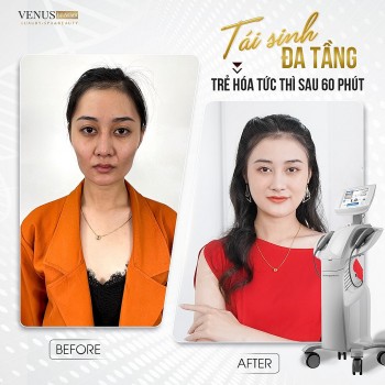 Giải mã vì sao Venus by Asian luôn là địa chỉ ruột của các tín đồ làm đẹp?