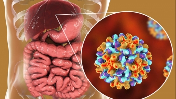 Hơn 8 triệu người Việt mắc viêm gan B: Đừng đợi bệnh nặng mới đi khám
